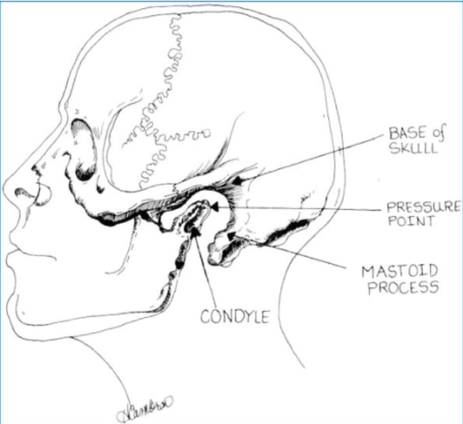 Distance CME Laryngospasm Causes and Cures