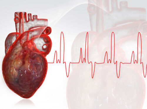 NREMT Congestive Heart Failure