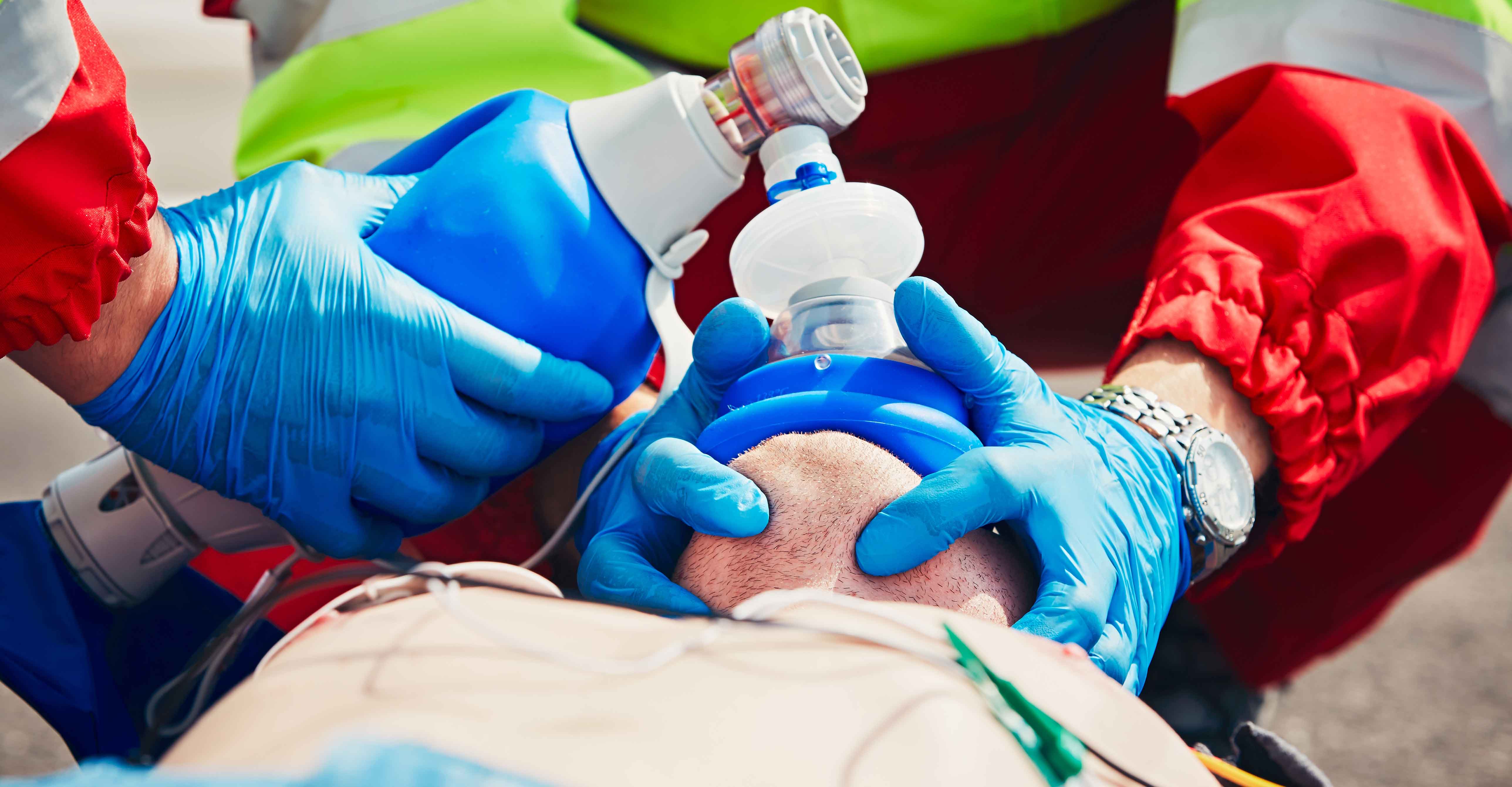 bag mask ventilation