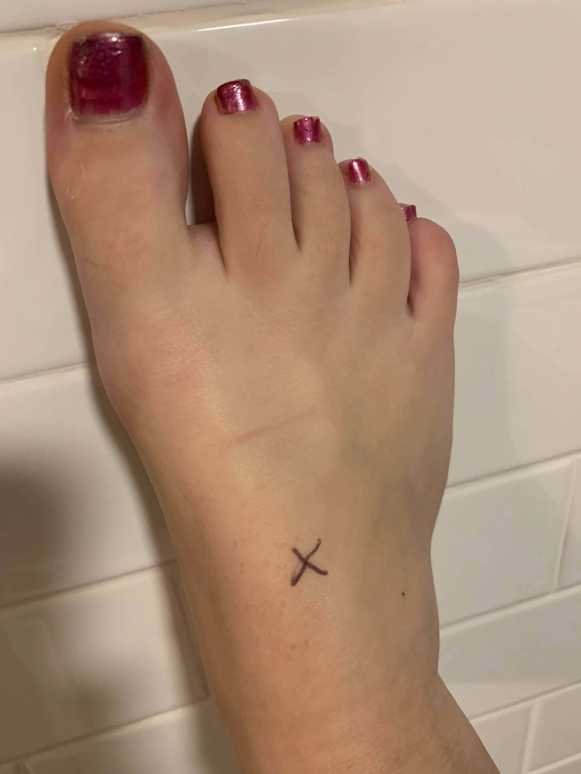 Pedal Pulse: Have You Mastered This Basic Assessment?