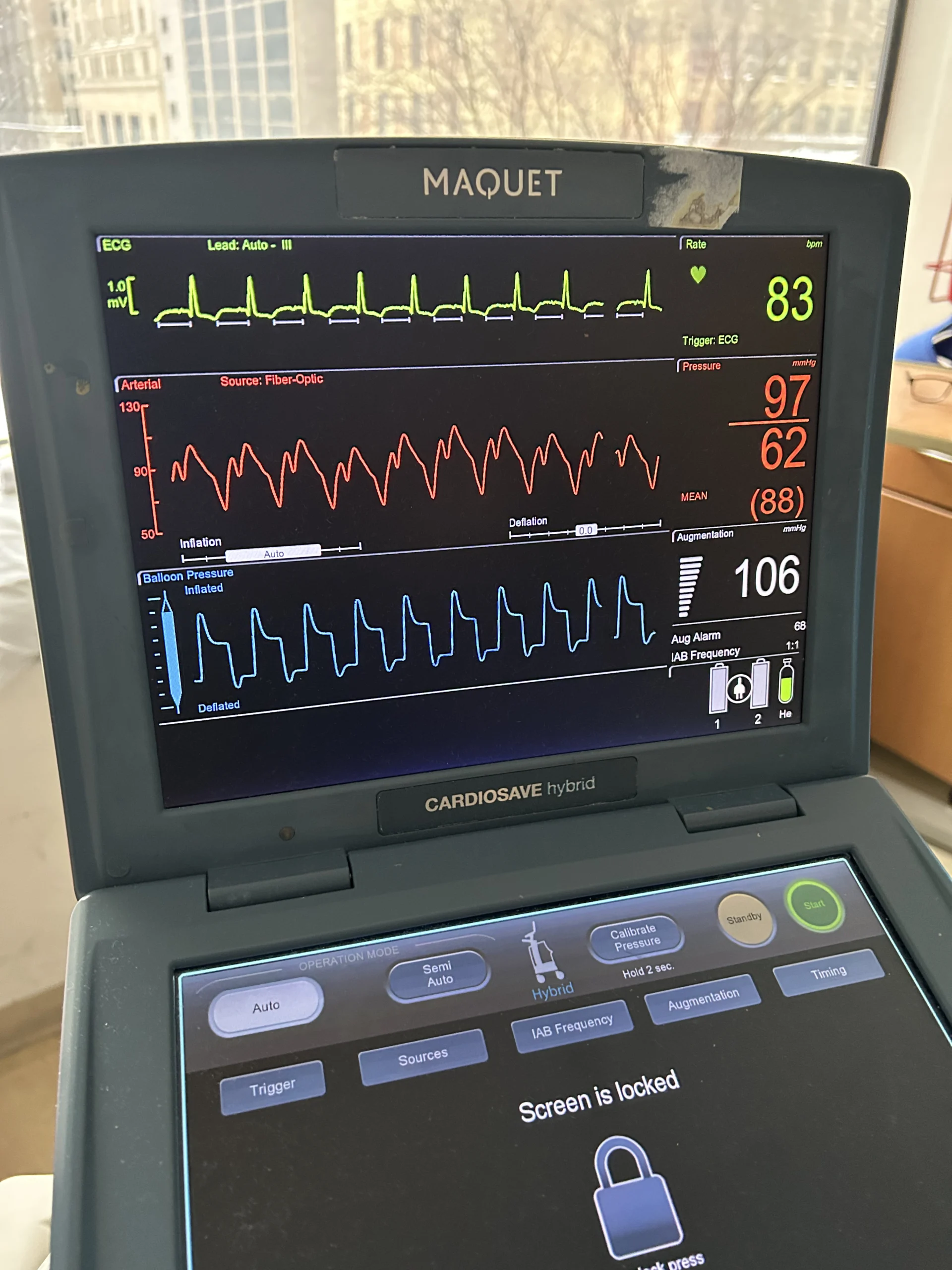 balloon pump screen