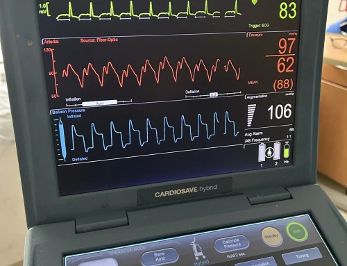 Counterpulsation (IABP) Demystified